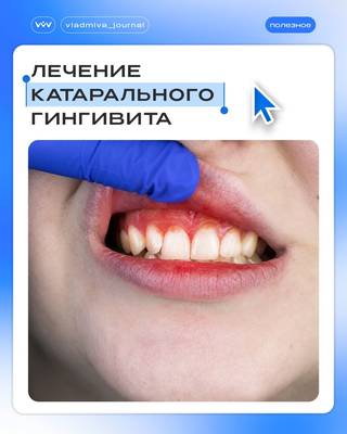 Профессиональная гигиена — ключ к лечению гингивита.